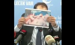 BİZİM ÇOCUKLAR KUYRUKLU MU DOĞACAK? Prof. Dr. Koray Topgül yazdı