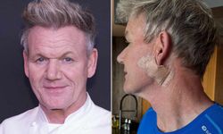 Ünlü şef Gordon Ramsay, cilt kanseri tedavisi gördüğünü açıkladı