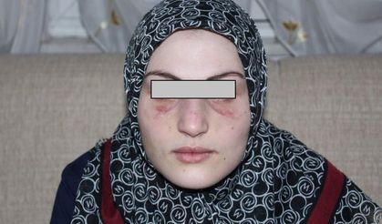 Kaçarak evlendi, 2 yıl şiddet gördü, kocasından şikayetçi oldu